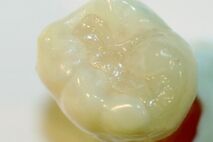 Cerec | Zahnarztpraxis Dugar in Konstanz