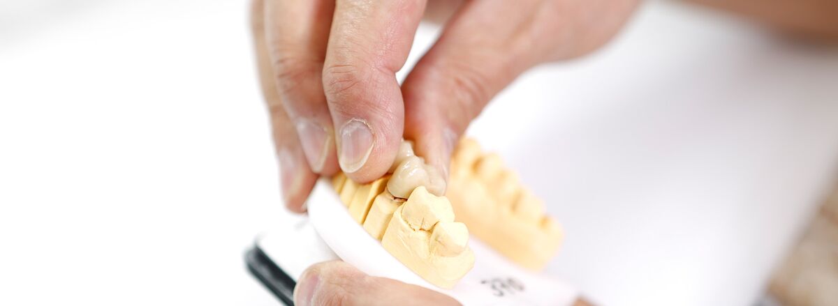 Individueller Zahnersatz von Ihrem Zahnarzt in Konstanz