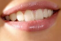 Professionelle Zahnreinigung | Zahnarztpraxis Dr. Schuh in Konstanz
